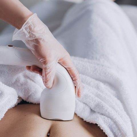 Revolucionando a Estética: HIFU, a esperança para o rejuvenescimento!