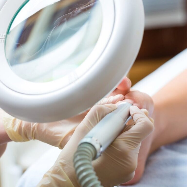 Pedicura Medical (Calista) + Laser Podológico